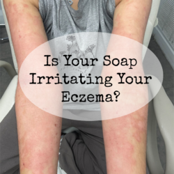 Read more about the article Is Your Soap Irritating Your Eczema?